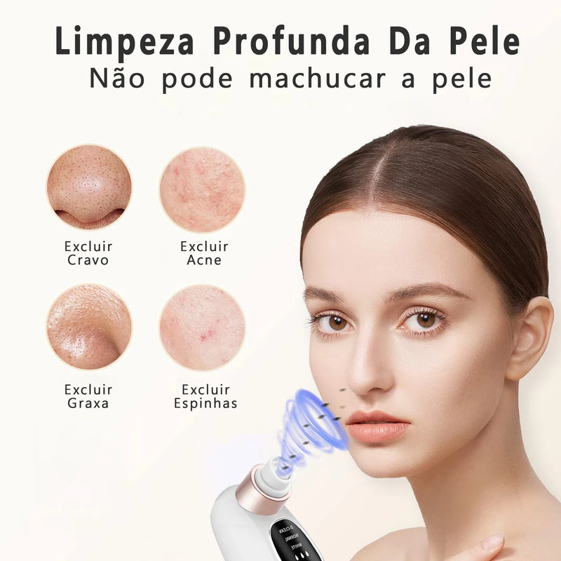 Removedor de Cravos PureSkin Pro™