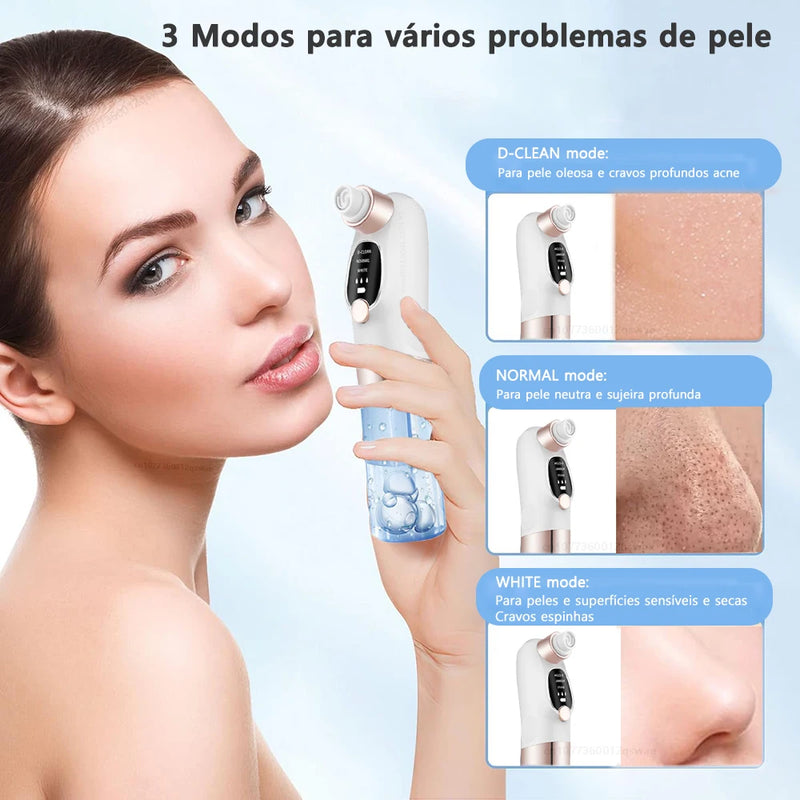 Removedor de Cravos PureSkin Pro™