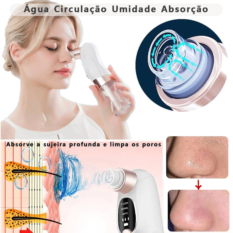 Removedor de Cravos PureSkin Pro™